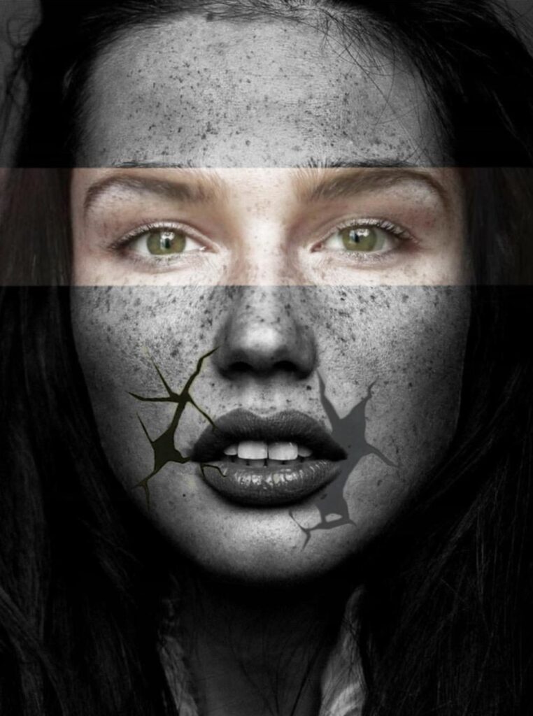 Ρυτίδες γέλιου